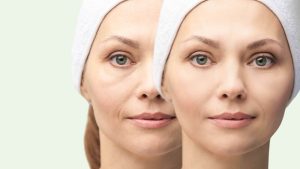 Fine Lines • Dull Skin • Elasticity Loss